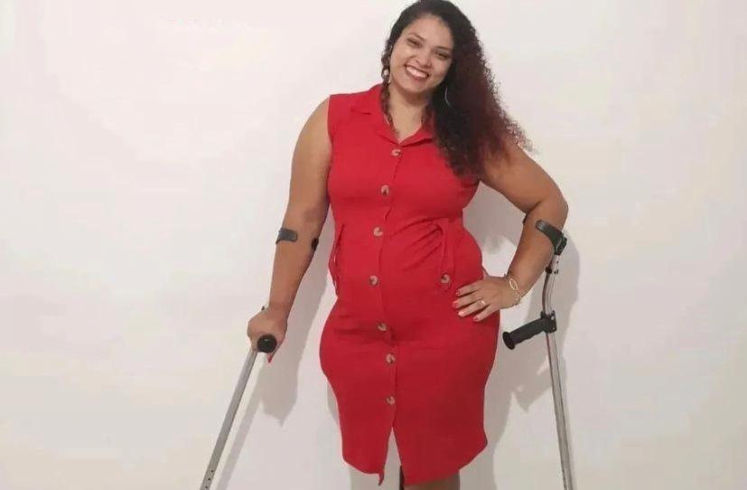 Atleta paralímpica de Poá pede ajuda para conquistar prótese de R$ 48 mil