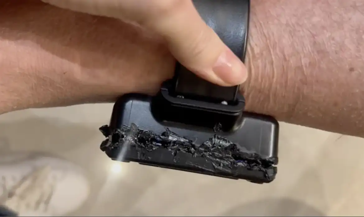 Vídeo: 'Usei ferro quente, de soldar', disse Bolsonaro sobre tornozeleira danificada