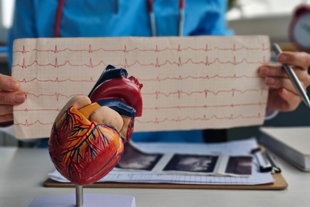 Mãos de um médico segurando um exame de eletrocardiograma em frente à anatomia de um coração 