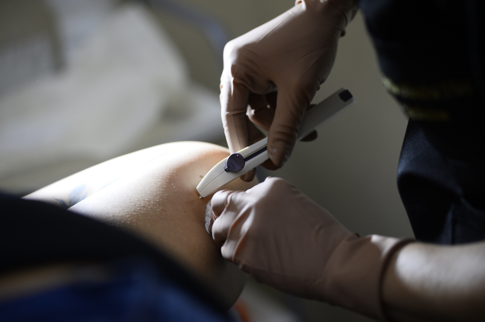 Vereadores aprovam oferta de implantes contraceptivos de graça em Mogi das Cruzes