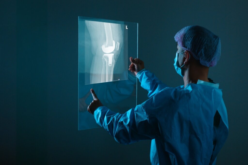 Médico olhando uma ultrassom de joelho 