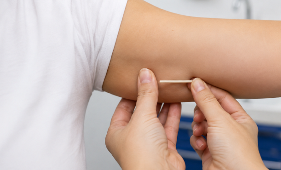 Anvisa amplia de três para cinco anos prazo de eficácia de implante contraceptivo; saiba mais